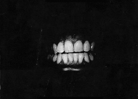 Gif animé bouche dents